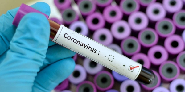 Вакцинация от COVID-19 во время новогодних дней будет проводиться ежедневно в Якутске