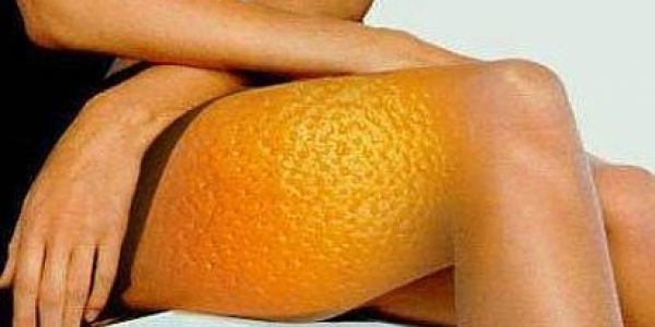 Эффект «апельсиновой корки»: правда и мифы