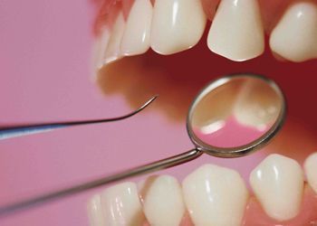 О здоровых зубах, кариесе и зубном камне